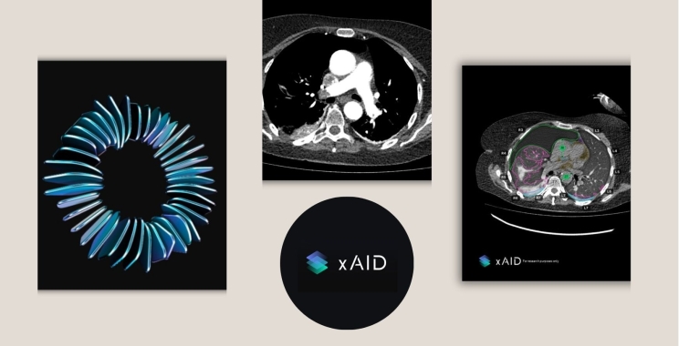 How to Choose AI Imaging Vendors That Fix Workflow Pain